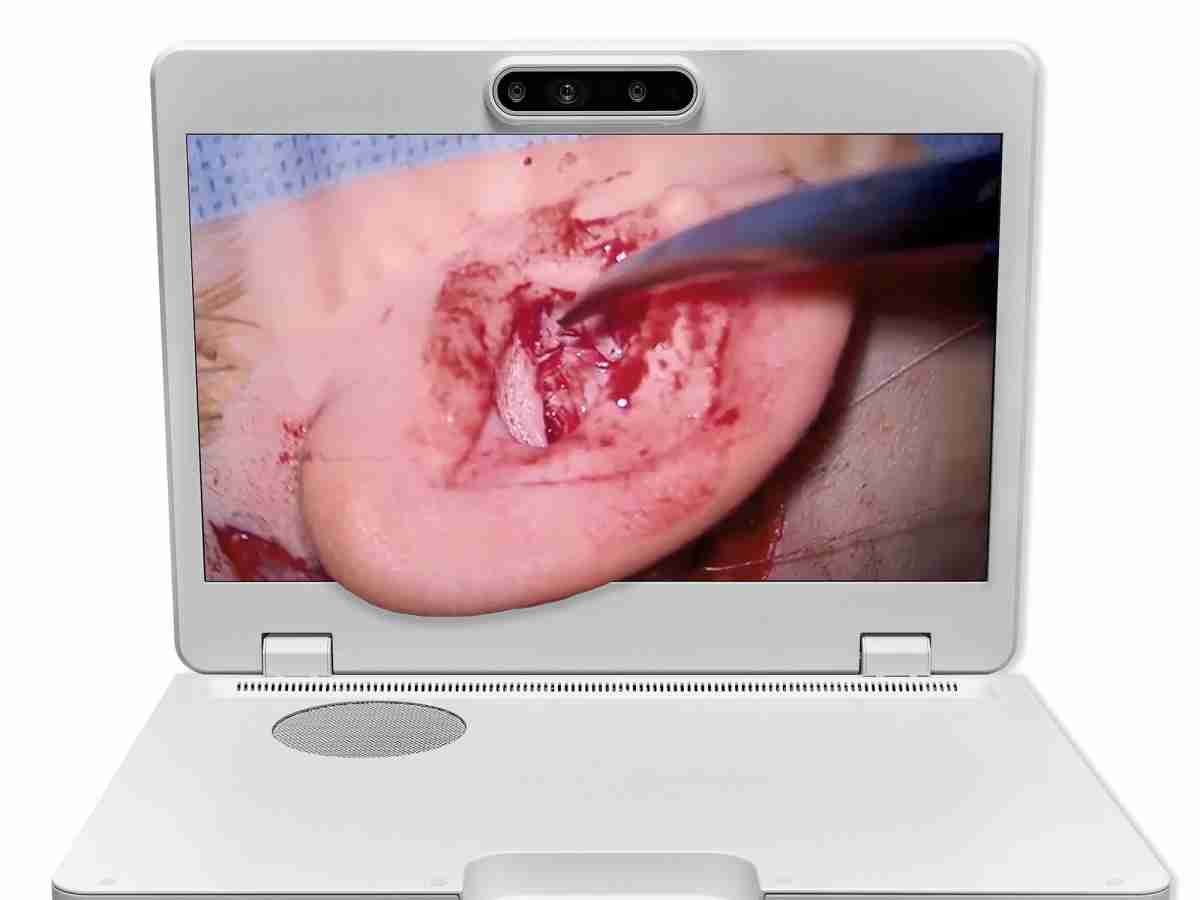 达擎之＂Heads-up 3D显微手术显示系统＂，，，，整合4K裸眼3D显示及眼球追踪系统，，，具备快速追踪人眼移动位置功能，，，减轻医师长时间维持固定姿势的负担，，让医师能有更宽广清晰的3D立体视野及更舒适的姿势来执行手术。。。